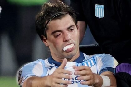 Santiago Sosa, visiblemente afectado tras recibir el codazo de Marcos Rojo en el cierre del partido ante Flamengo, que le provocó una fractura en el rostro.