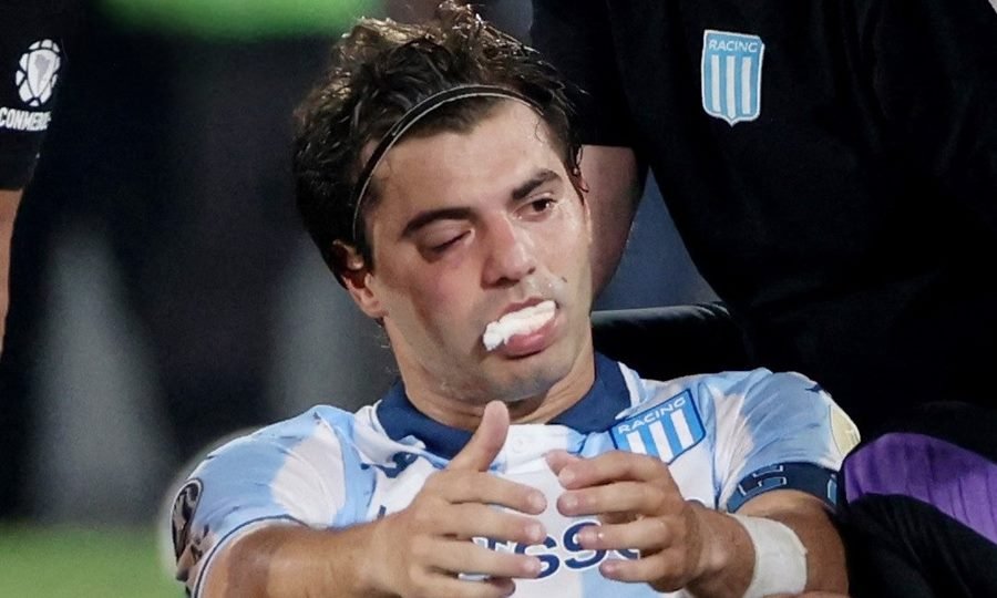 Santiago Sosa, visiblemente afectado tras recibir el codazo de Marcos Rojo en el cierre del partido ante Flamengo, que le provocó una fractura en el rostro.