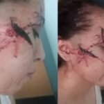 Violento ataque a una adolescente en San Cristóbal: la causa avanza con personas detenidas.