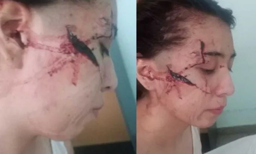 Violento ataque a una adolescente en San Cristóbal: la causa avanza con personas detenidas.