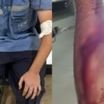 Trabajador de la EPE herido recibe atención médica tras ser atacado por una jauría de perros durante tareas en la vía pública en Santa Fe.