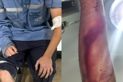 Trabajador de la EPE herido recibe atención médica tras ser atacado por una jauría de perros durante tareas en la vía pública en Santa Fe.