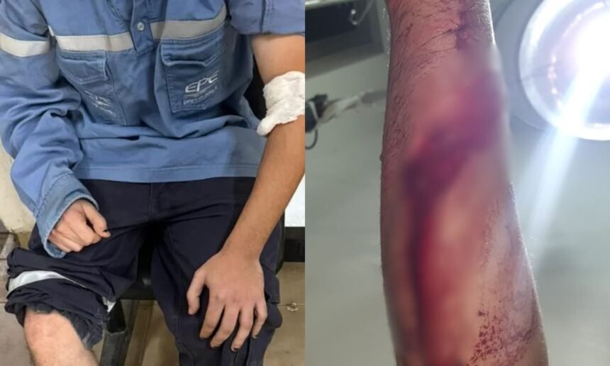 Trabajador de la EPE herido recibe atención médica tras ser atacado por una jauría de perros durante tareas en la vía pública en Santa Fe.