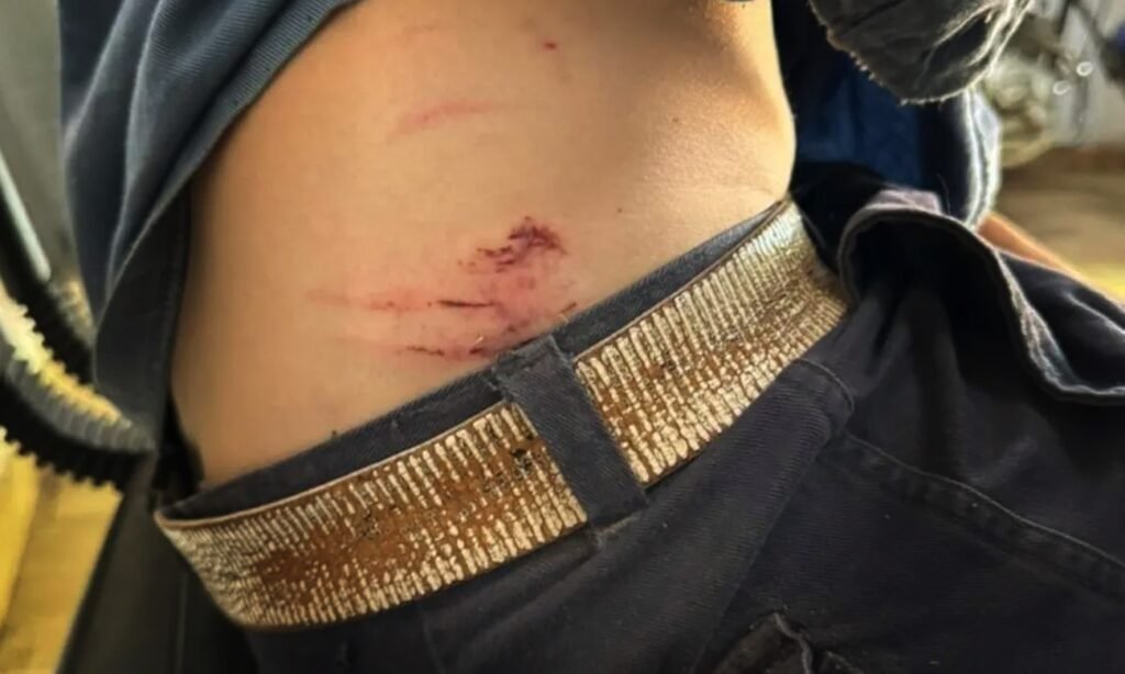 Operario de la EPE con lesiones visibles permanece internado y en recuperación tras el ataque de varios perros durante su jornada laboral en Santa Fe.