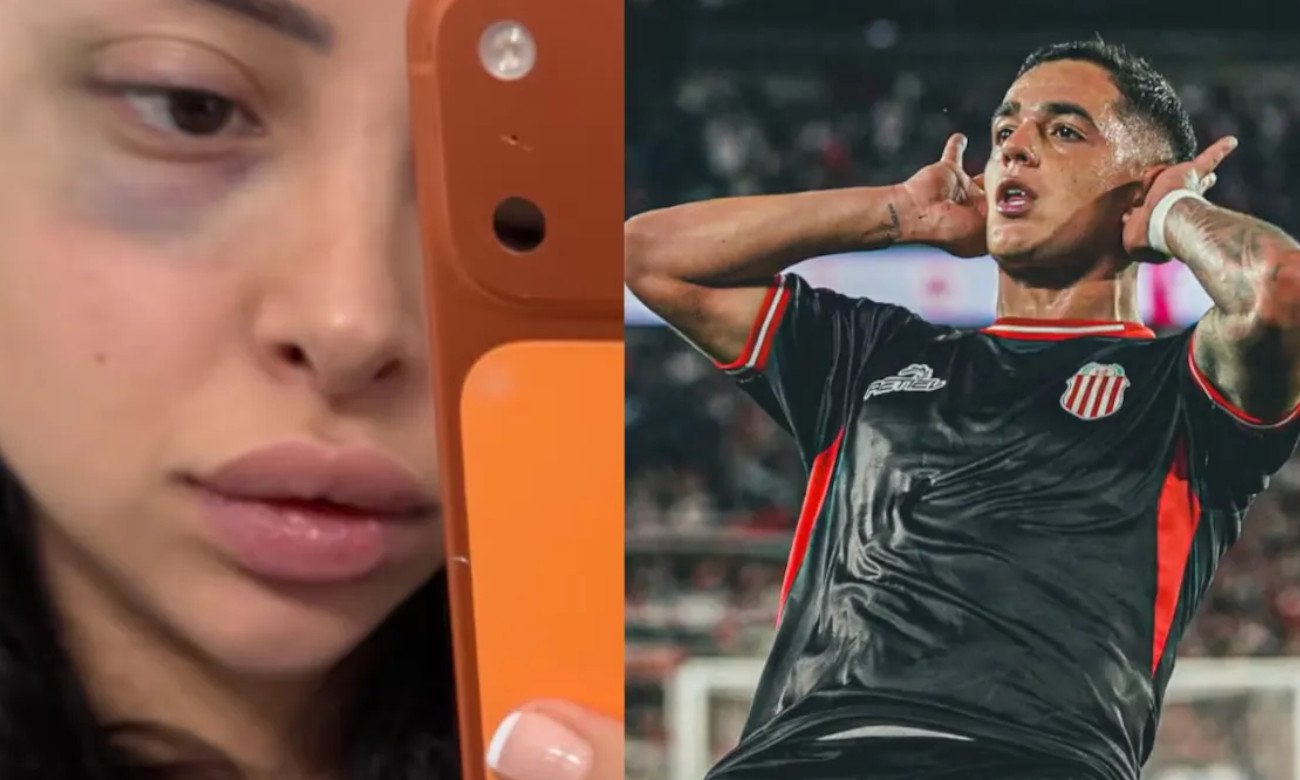Karen Dinna mostró imágenes de las lesiones que denunció haber sufrido. La composición incluye una fotografía de Gonzalo Morales, ex atacante de Unión y actual jugador de Barracas Central.